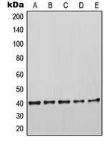 CPA1667-100ul - Cytokeratin 19