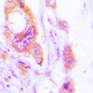CPA1668-100ul - Cytokeratin 19