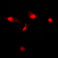 CPA1679-100ul - Galectin-3