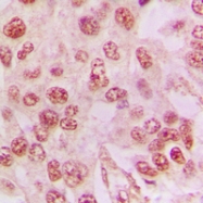 CPA1679-100ul - Galectin-3
