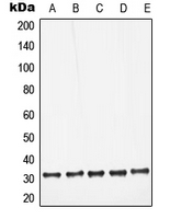 CPA1679-100ul - Galectin-3