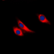 CPA1680-100ul - Galectin-9