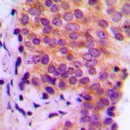 CPA1680-100ul - Galectin-9