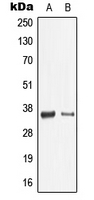 CPA1680-100ul - Galectin-9