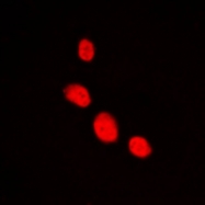CPA1682-100ul - LHX1