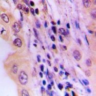 CPA1688-100ul - LIPC / Hepatic lipase