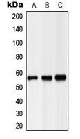 CPA1688-100ul - LIPC / Hepatic lipase
