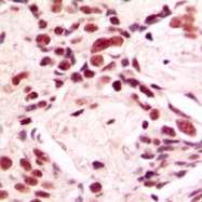 CPA1690-100ul - Lamin-A/C (LMNA)