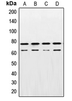 CPA1690-100ul - Lamin-A/C (LMNA)