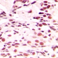 CPA1691-100ul - Lamin-A/C (LMNA)