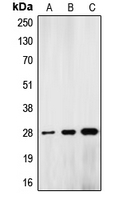 CPA1691-100ul - Lamin-A/C (LMNA)