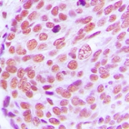 CPA1692-100ul - Lamin-A/C (LMNA)