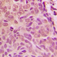CPA1705-100ul - SMAD1