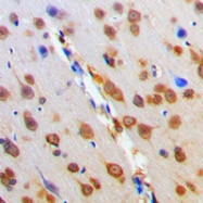 CPA1725-100ul - MC4-R