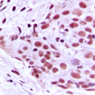 CPA1727-100ul - MCM2