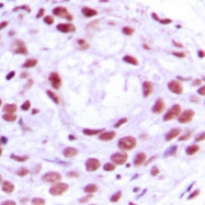 CPA1729-100ul - MCM4