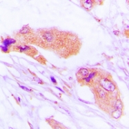 CPA1747-100ul - MMP-1
