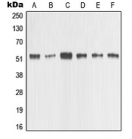 CPA1747-100ul - MMP-1