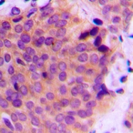 CPA1748-100ul - MMP-2