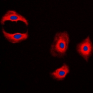 CPA1749-100ul - MMP-3