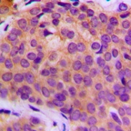 CPA1749-100ul - MMP-3