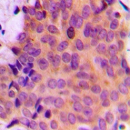 CPA1751-100ul - MMP-7