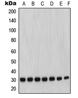 CPA1751-100ul - MMP-7