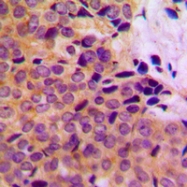 CPA1752-100ul - MMP-8