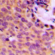 CPA1753-100ul - MMP-9
