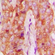 CPA1756-100ul - MMP-13