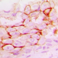 CPA1757-100ul - MMP-14 / MT1-MMP