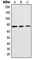 CPA1768-100ul - MTHFR