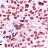 CPA1777-100ul - c-Myc