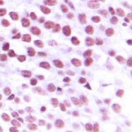 CPA1786-100ul - Nibrin