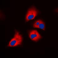 CPA1796-100ul - Neurofibromin
