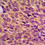 CPA1796-100ul - Neurofibromin