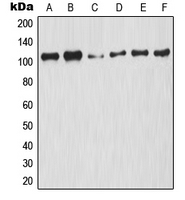 CPA1798-100ul - NF-kB p105 / p50