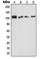 CPA1799-100ul - NF-kB p105 / p50
