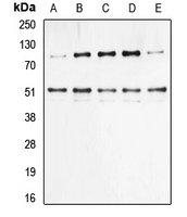 CPA1800-100ul - NF-kB p105 / p50