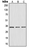 CPA1803-100ul - NFKBIA / IKBA