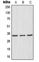 CPA1804-100ul - NFKBIA / IKBA