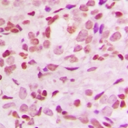 CPA1805-100ul - NFKBIA / IKBA