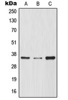 CPA1805-100ul - NFKBIA / IKBA