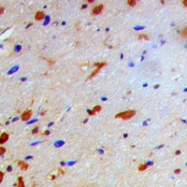 CPA1807-100ul - NFKBIB / IKBB