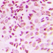 CPA1813-100ul - NKX3-1