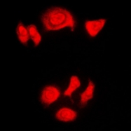 CPA1825-100ul - Nucleophosmin