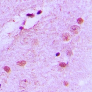 CPA1825-100ul - Nucleophosmin