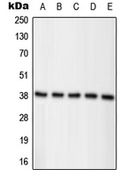 CPA1826-100ul - Nucleophosmin