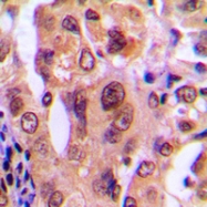 CPA1827-100ul - Nucleophosmin