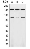 CPA1832-100ul - TrkB